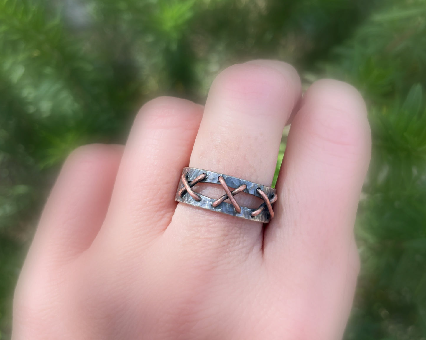 stitched ring sutures ring